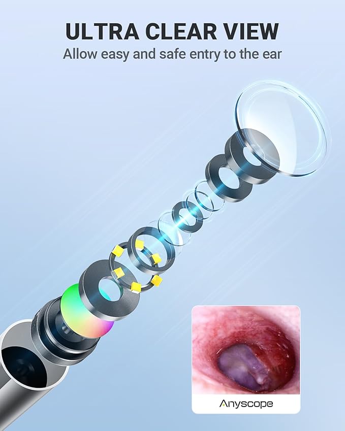 Digital Otoscope Compatible with iPhone and Android Devices, HD Ear Camera with Ear Wax Removal Tools, Video Ear Scope Otoscope with Light, Capture Photos and Videos (Purple)