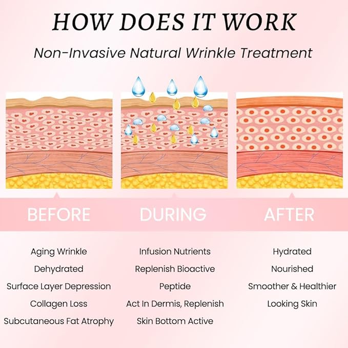 Kaely Wrinkle Patches for Face Overnight, Silicone Scar Tape for Wrinkles Forehead, Smile Line, Face Tape for Wrinkles Overnight Sleeping Lifting Sagging Skin, 192 Pcs (12 Sheets of 16 Patches)