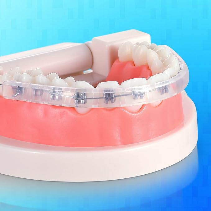 Comfort Covers for Braces - Orthodontic Mouth Guard, Lip Protector, Wax Alternative, Lip Shield for Brackets