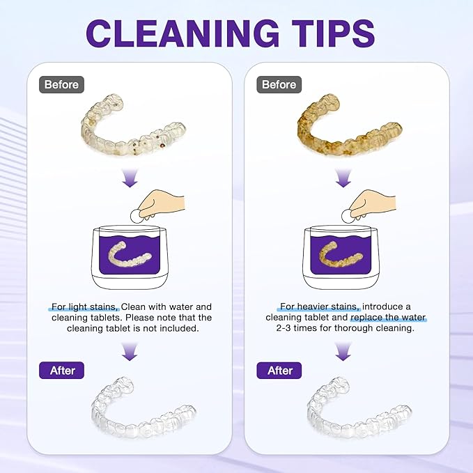 Ultrasonic Retainer Cleaner 320ML, 45kHz Denture Cleaner with 4 Lamps, Dental Cleaning Pod for Mouth Guard, Aligner, Braces, Toothbrush Head, Jewelry
