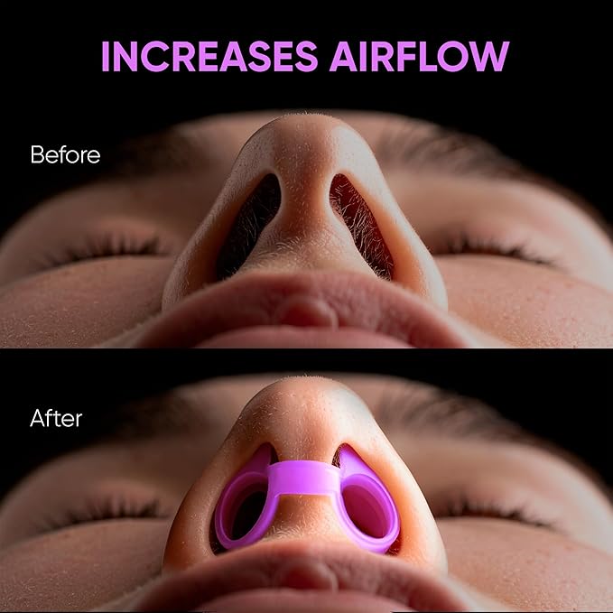 Anti Snoring Devices – Nasal Dilators - Nose Clips for Snore Relief & Better Sleep – Comfortable Silicone Snore Stopper – Anti Snoring Nose Vents – 8 Pack + Travel Case (Purple)