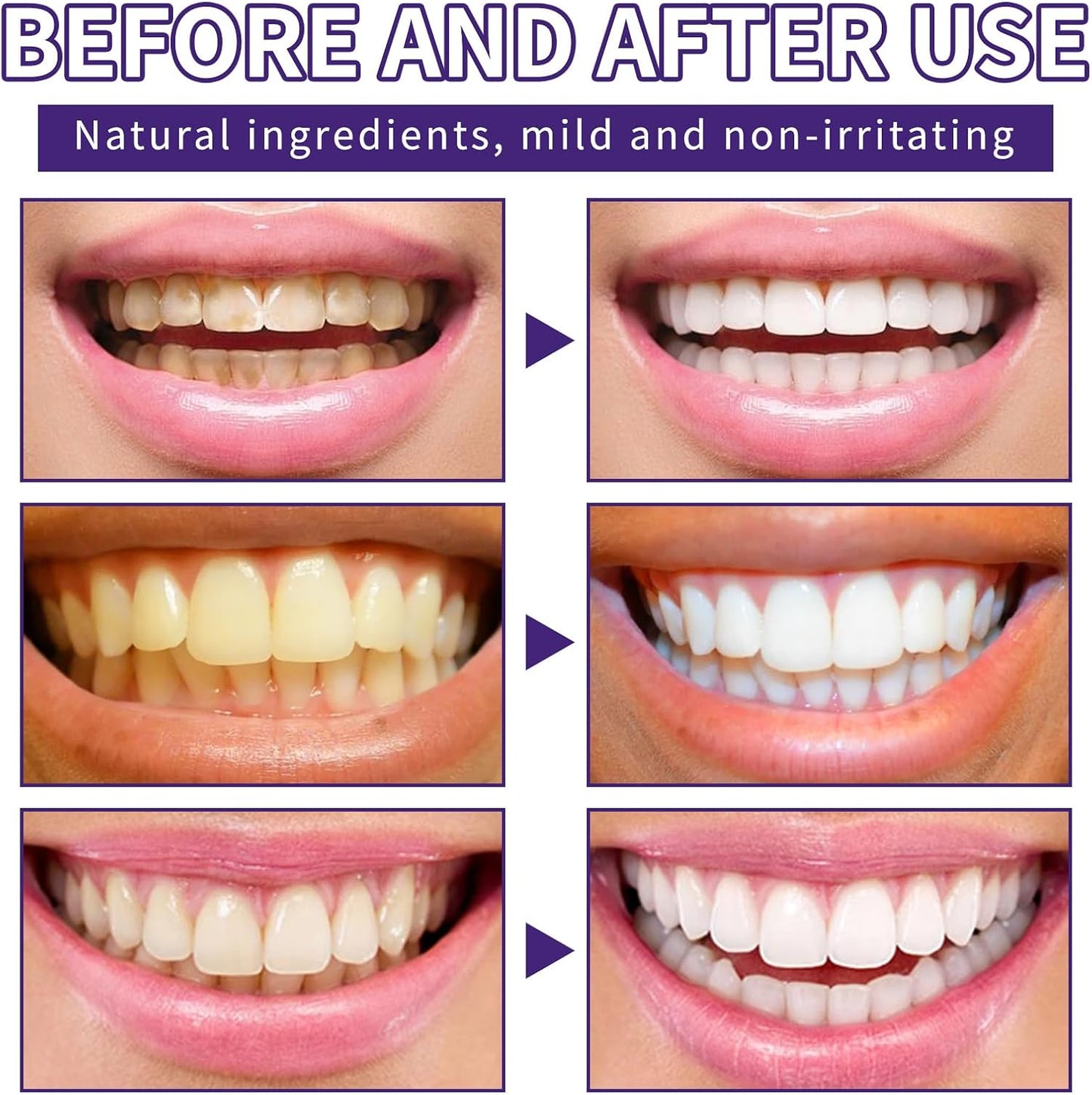 BBOJI Teeth Restoration Mineral Powder, Advanced Tooth Restoration Powder - Effective in Strengthening Teeth and Gums, Protect Gums and Freshen Breath (1 Pack)