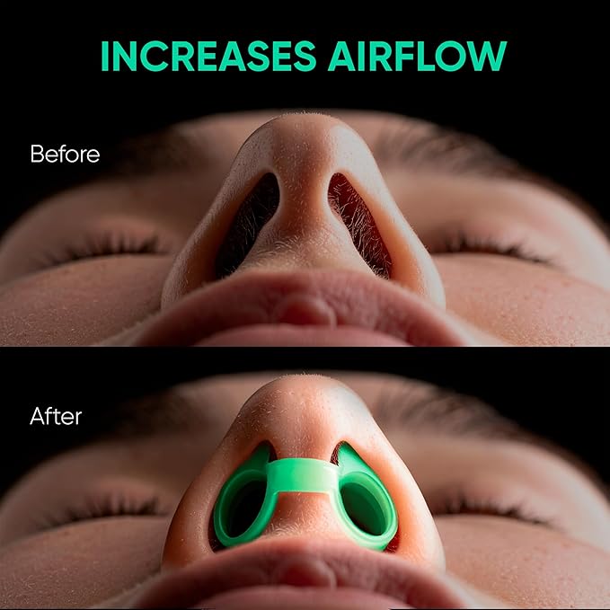 Anti Snoring Devices – Nasal Dilators - Nose Clips for Snore Relief & Better Sleep – Comfortable Silicone Snore Stopper – Anti Snoring Nose Vents – 8 Pack