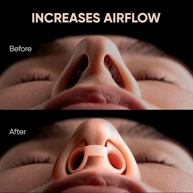 Anti Snoring Devices – Nasal Dilators - Nose Clips for Snore Relief & Better Sleep – Comfortable Silicone Snore Stopper – Anti Snoring Nose Vents – 8 Pack + Travel Case