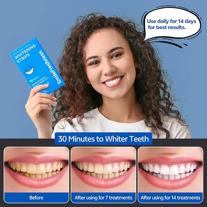 Teeth Whitening Strips, 14-Day Treatments Clinically Proven for Visible & Affordable Teeth Whitening, Enamel Care Whitening, Reduced Sensitivity Formula, Mint.