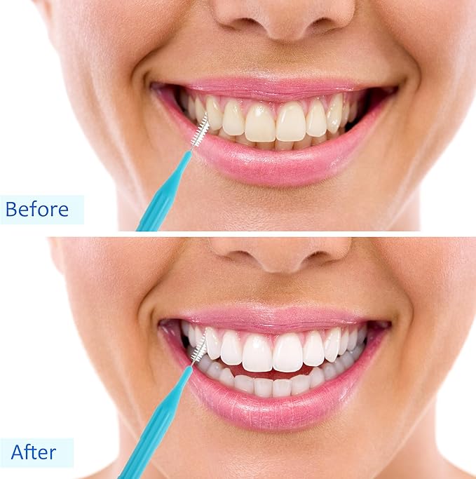 Patelai 100 Pieces Braces Brush for Cleaner Interdental Brush Toothpick Dental Flossing Head Oral Hygiene Flosser Tooth Cleaning Tool (Light Blue)