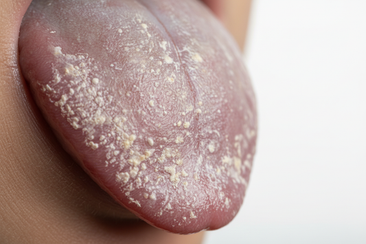 Why Your Tongue Might Be Causing Bad Breath