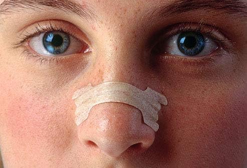 60 Count New-Happy Nasal Strips(66mm*19mm)
