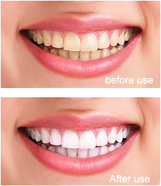 100% Pure Nano Hydroxyapatite Tooth Powder – Enamel Remineralization Support, Fluoride-Free Toothpaste Additive for Sensitivity & Cavity Defense, Pure HAp Powder 500 Grams