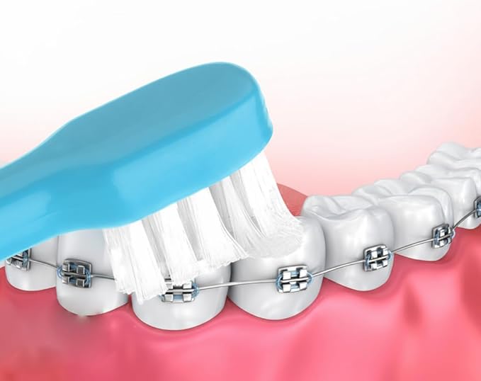 End Tuft Toothbrush, 4PCS Nylon Soft Bristle, Small Tooth Brush for Hard-to-Reach Areas, Dental Detail Cleaning for Adults with Crowns, Bridges, Implants