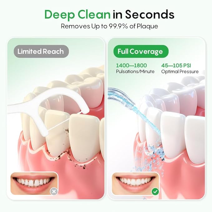 FRESKO Water Flosser, 300ML Portable Cordless Water Dental Flossers for Teeth Deep Cleaning, Rechargeable Oral Irrigator Teeth Pick for Travel Home Use and Braces Care, IPX7 Waterproof