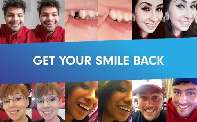 Temptooth #1 Seller Trusted Patented Temporary Tooth Replacement Product