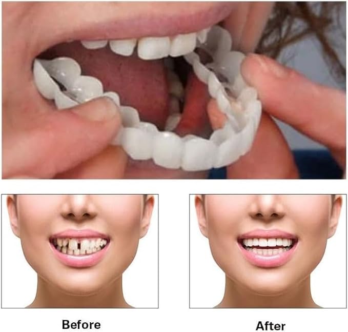 2 Pairs, Temporarily Adjustable for Men and Women, Regain Confidence Smile Teeth Whitening Kits(White) (1)