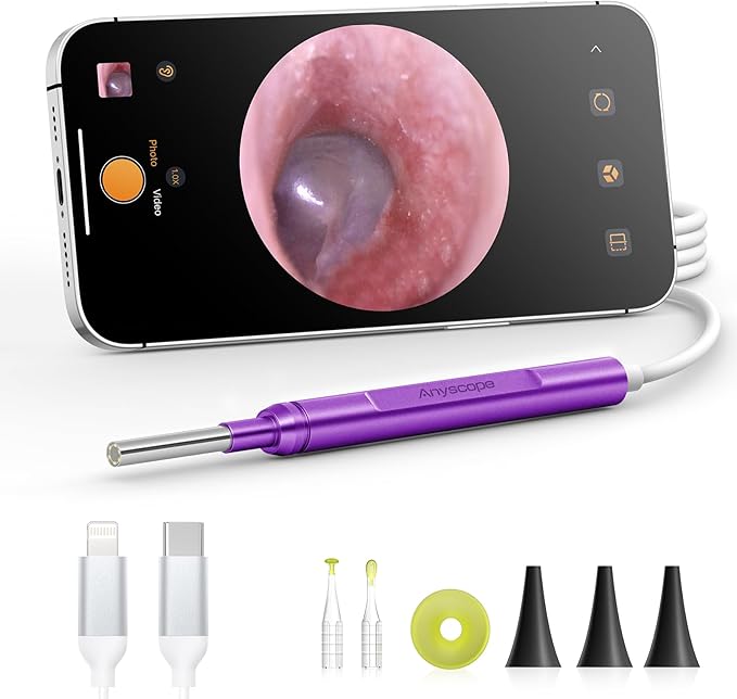 Digital Otoscope Compatible with iPhone and Android Devices, HD Ear Camera with Ear Wax Removal Tools, Video Ear Scope Otoscope with Light, Capture Photos and Videos (Purple)