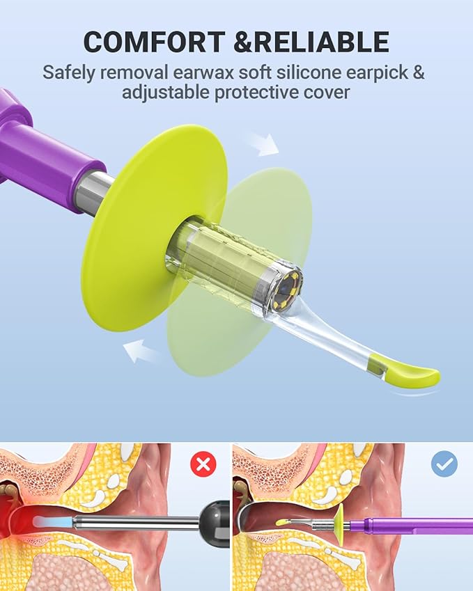Digital Otoscope Compatible with iPhone and Android Devices, HD Ear Camera with Ear Wax Removal Tools, Video Ear Scope Otoscope with Light, Capture Photos and Videos (Purple)