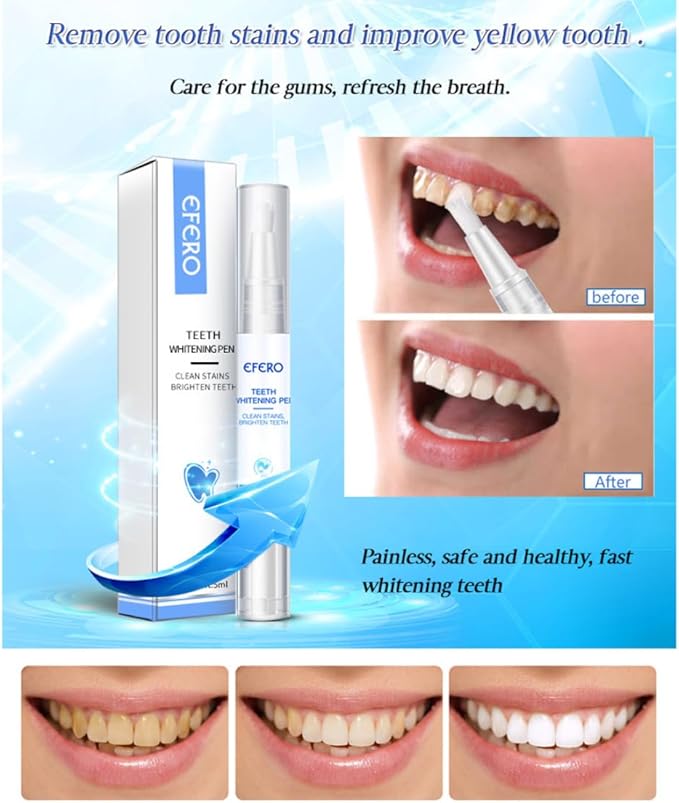 Teeth Whitening Teeth Whitening Gel Pen Essence for Tooth Instant Polish White Style1, Pen