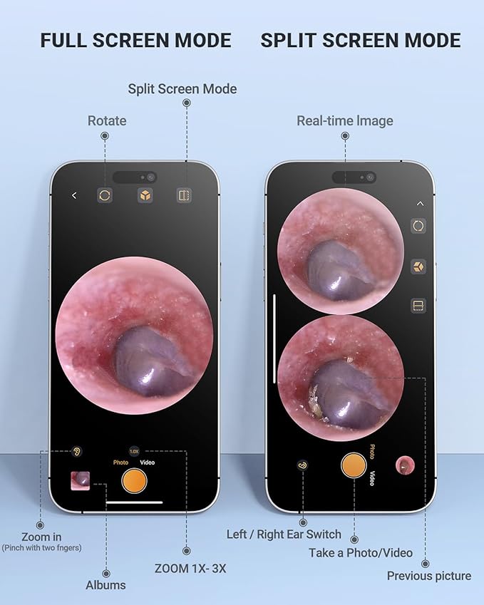 Digital Otoscope Compatible with iPhone and Android Devices, HD Ear Camera with Ear Wax Removal Tools, Video Ear Scope Otoscope with Light, Capture Photos and Videos (Purple)