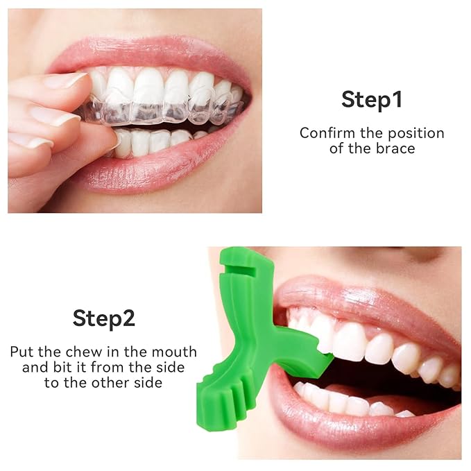 Chewies for Invisalign Aligner, DLENP 4 PCS Y-Shaped Invisalign Trays Seater, Orthodontic Dental Chewies Munchies(2Pcs Unscented, 2 Pcs Mint Scented)