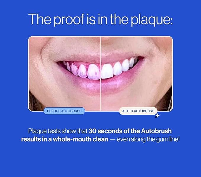 Autobrush Fluoride-Free Foaming Toothpaste for Kids, Strawberry Flavor, Whitening & Deep Cleaning, Travel Friendly, Anti-Cavity (Pack of 2)