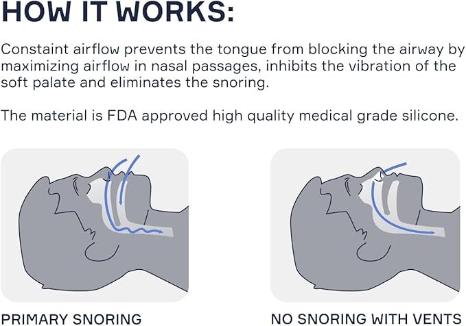 Nasal Dilators for Sleeping - 4 of X-Large ONLY (XL) Soft Silicone Nasal Cones - Nostril Opener - Nasal Expander for Breathing - Nose Vents - Anti Snoring Devices