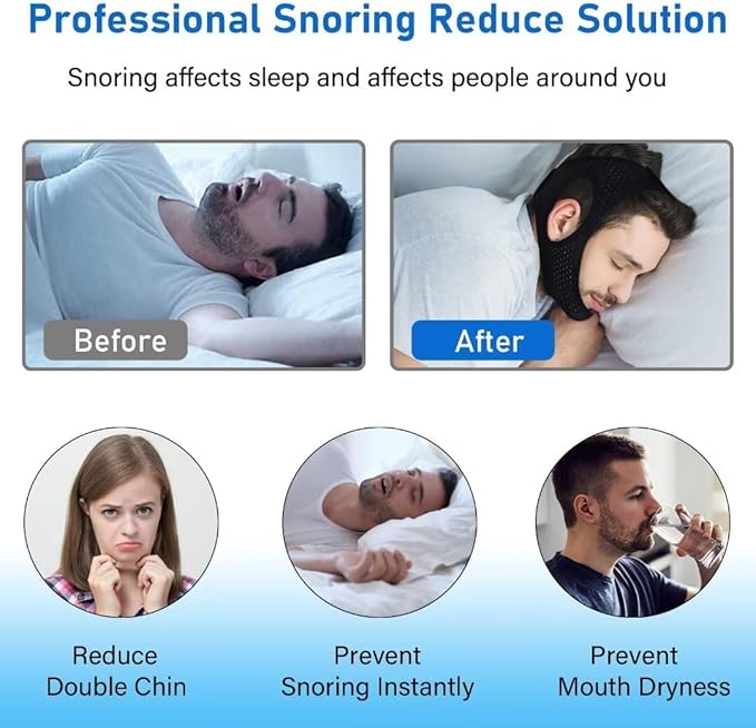 Forzacx Anti Snore Chin Strap - Breathable Chin Strap Snoring Solution, Effectively Reduce Snoring, Non-Stick Hair, Don't Fade - Black