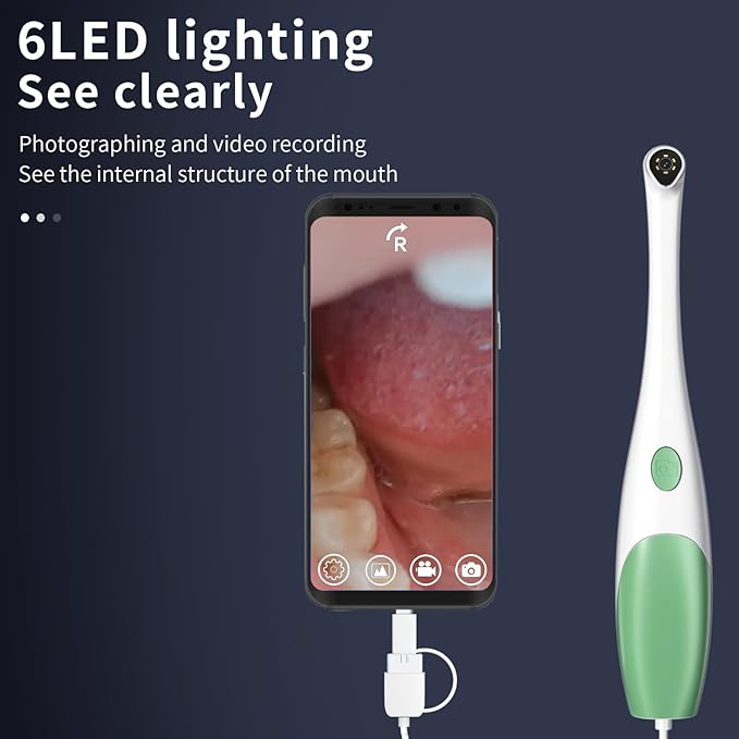 Super Clear Intraoral Camera&Dental Camera,Visual Intraoral Camera Dental with Mirco USB/Type-C/USB Connector for Personal Android Devices,Easy to Use for Android or PC(Not for iPhone)