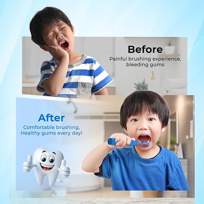 6 Pack Toothbrush Replacement Heads Compatible with Burst Kids Electric Toothbrush, Burst Kids Replacement Heads with Ultra-Soft Bristles, Dust Cover Caps, Perfectly Compatible (Blue)
