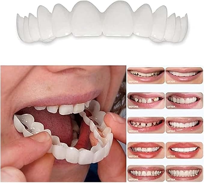 2 Pairs, Temporarily Adjustable for Men and Women, Regain Confidence Smile Teeth Whitening Kits(White) (1)
