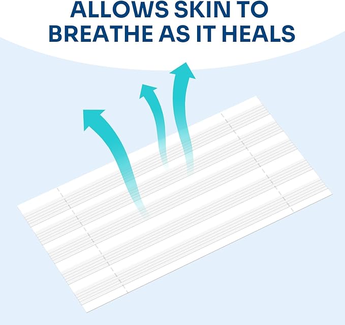 Conkote Wound Closure, Breathable Strips Hold Small Wounds Firmly Closed, Great After Sutures or Staples - 40 Wound Closures