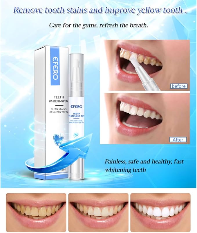 Teeth Whitening Gel Pen Essence for Tooth Instant Polish White Style1