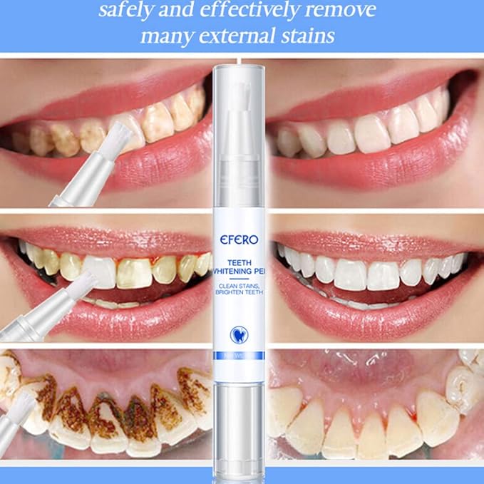Teeth Whitening Teeth Whitening Gel Pen Essence for Tooth Instant Polish White Style1, Pen
