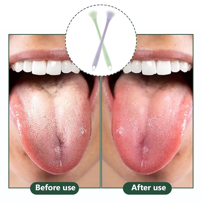 2Pcs Multifunctional Silicone Tongue Scrapers for Adults and, Portable Double-Sided Tongue Cleaners in Mint Green and Lavender for Oral Hygiene and Bad Breath Removal