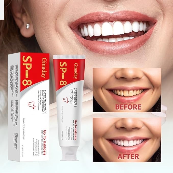 Sp-8 Probiotic Whitening Toothpaste, with Probiotics Oalance Oral Microbiota, Niacinamide Whitening Toothpaste for Enamel Protection and Gum Health Fresh Breath, Fluoride-Free.-1Pcs
