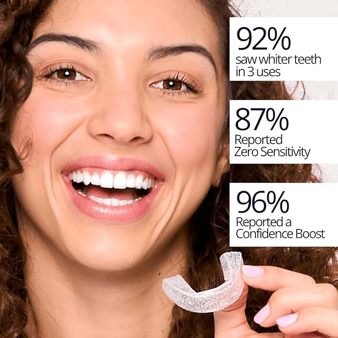 Max Glow Trays – 12HP Prefilled Teeth Whitening Trays – 10 Treatments, 12% Hydrogen Peroxide Gel. Custom-Fit. Enamel Safe. On-The-Go Better Than Strips. Suitable Sensitive Teeth.