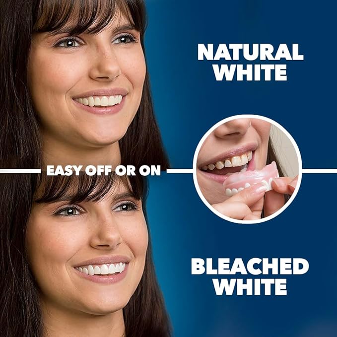 Imako Premium Cosmetic Uppers - 1 Pack - Small, Natural White - DIY Smile Makeover - Made in USA