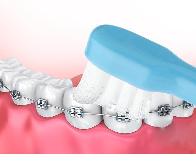 WLLHYF End Tuft Toothbrush, 4PCS Nylon Soft Bristle Tiny Small Tooth Brush, Hard to Reach Areas Dental Detail Cleaning for Adults-Around Crowns Bridges Implants