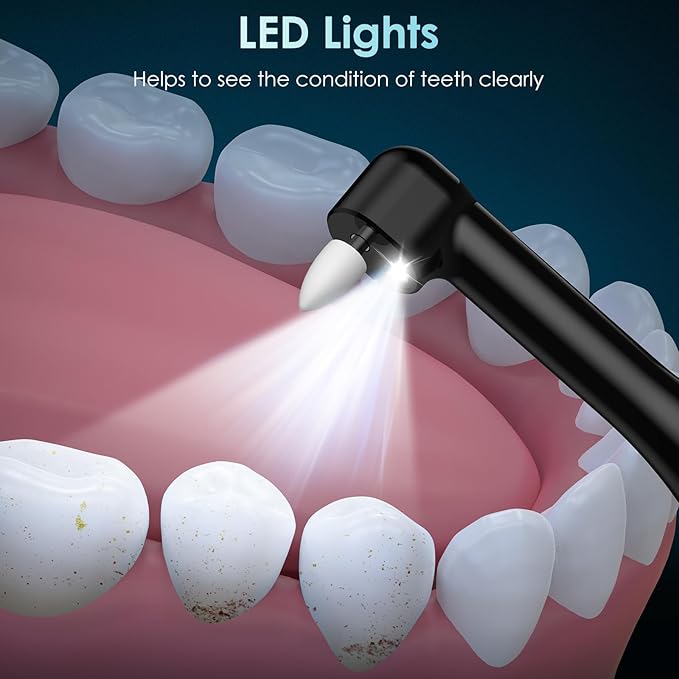 Tooth Polisher, Rechargeable Teeth Polisher with 5 Brush Heads, 4 Speed Modes, Tooth Whitening Kit for Cleaning and Polishing, LED Light, 3 Polish Pastes, IPX6 Waterproof Teeth Cleaning Tools, Black