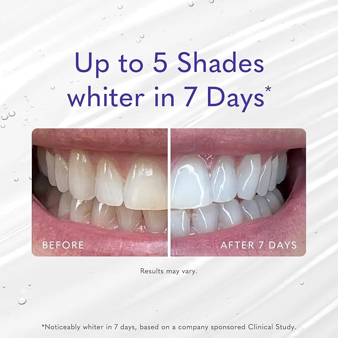 Smileactives Teeth Whitening Gel for Toothpaste with Clinical-Grade Hydrogen Peroxide, Tooth Stain Remover for White Teeth, Dentist Quality Pro Whitening Gel to Remove Stains, 90 Day, 3.8 oz Bottle