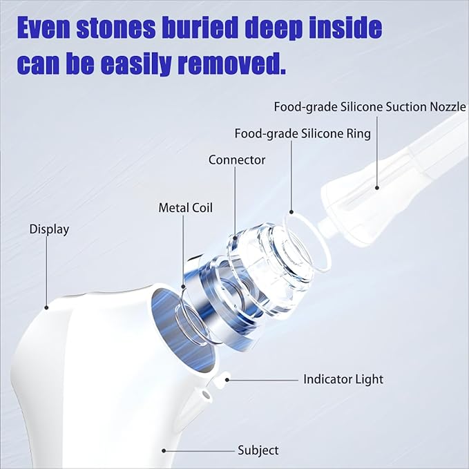 Electric Tonsil Stone Remover – High-Precision & Painless Cleaning, Food-Grade Suction Tool with LED Light, 12 Attachments & Vacuum Cleaning for Tonsil Stones, Bad Breath Relief