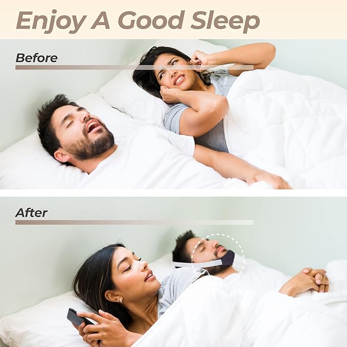 PalpitateC Upgrades Chin Strap Effective Mouth-Snoring Relief, Anti Snoring Men Women Universal, Adjustable Snoring Solution Effectively Regulate Snoring and Regulate Sleep, Chin Strap Resmed - 1 Pack