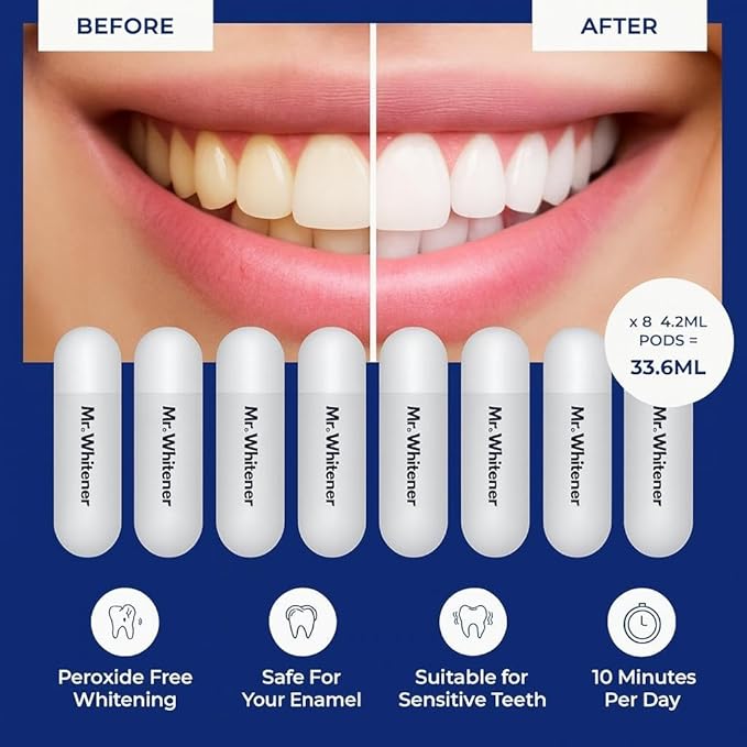 LED Teeth Whitening Kit, Dentists Recommended, Enamel Safe, Professional Pap Tooth Whitener for Sensitive Teeth, Professional 8 Refill Teeth Whitening Gel Pods 33.6ml, Remove Teeth Stains