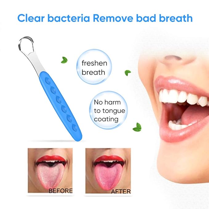 New Version Tongue Scraper Cleaner for Adults & Kids, Medical Grade Metal Tongue Brushes Set for Fresh Breath Dental Eliminate Bad Breath in Seconds (Blue)