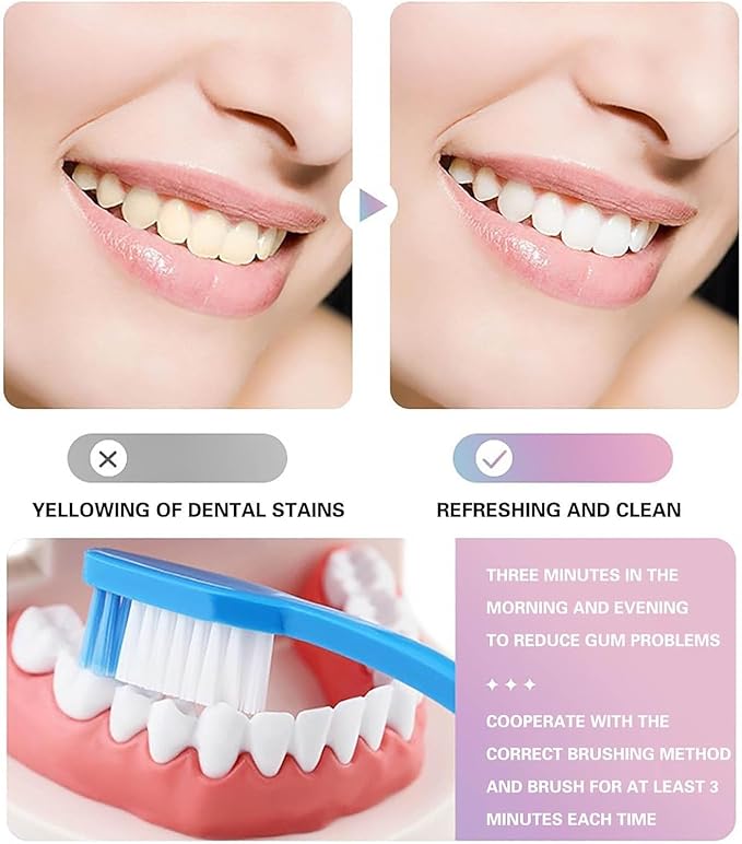 2Pcs Acssart Radiant Whitening Toothpaste,Niacinamide Whitening Toothpastes, Fresh Breath Stain Removal