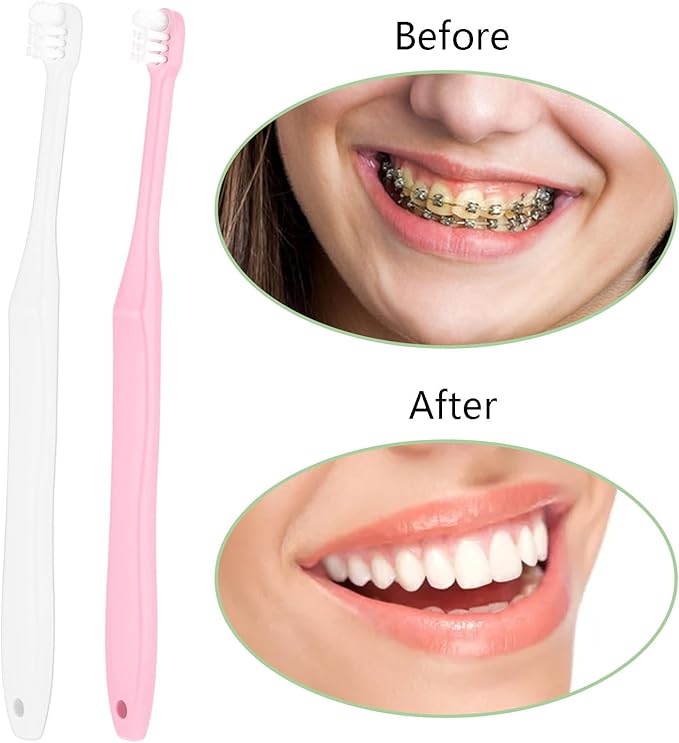 WLLHYF 2 Pieces Tuft Toothbrush Small Head End Tapered Interdental Interspace Nursing Soft Tiny Toothbrush Orthodontic Periodontal Dental Products(Blue + Green)