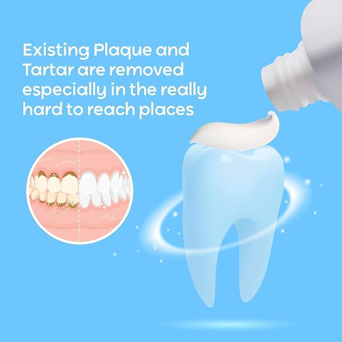 Plaque & Tartar Remover Toothpaste for Teeth: Removes Plaque & Controls Tartar Build-up - Long-Lasting Fresh Breath, Deep Cleansing & Gum-Friendly Formula (Wintergreen)