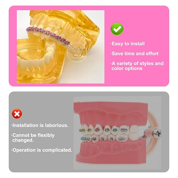 4 Pair of Temporary Tooth Decoration, Teeth Retainer Practical Brackets para Dientes Sturdy Retenedores de Dientes Ortodoncia Props for Dental Students to Practice (Pink)