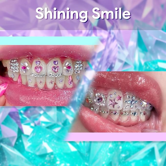 Luretrap Tooth Gem Kit with 400 pcs Crystals for Sparkling Smiles