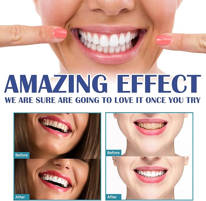 Gum Instant Soothing Gel for Gum Care, Teeth Whitening, Plaque Removal, 4ml, 0.14fl oz