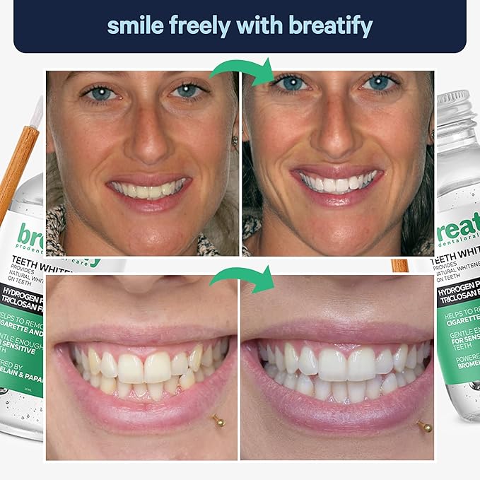 Teeth Whitening Gel, Natural Whiteness, Effective, Painless, No Sensitivity, Easy to Use, Removes Stains and Yellowing on The Teeth, 0.67 Fl Oz