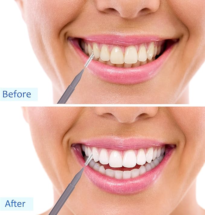 Patelai 100 Pieces Braces Brush for Cleaner Interdental Brush Toothpick Dental Tooth Flossing Head Oral Dental Hygiene Flosser Toothpick Cleaners Tooth Cleaning Tool(Pink, Grey,Ideal Size)